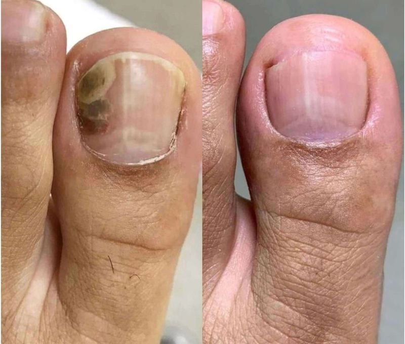 Toenail appearance comparison