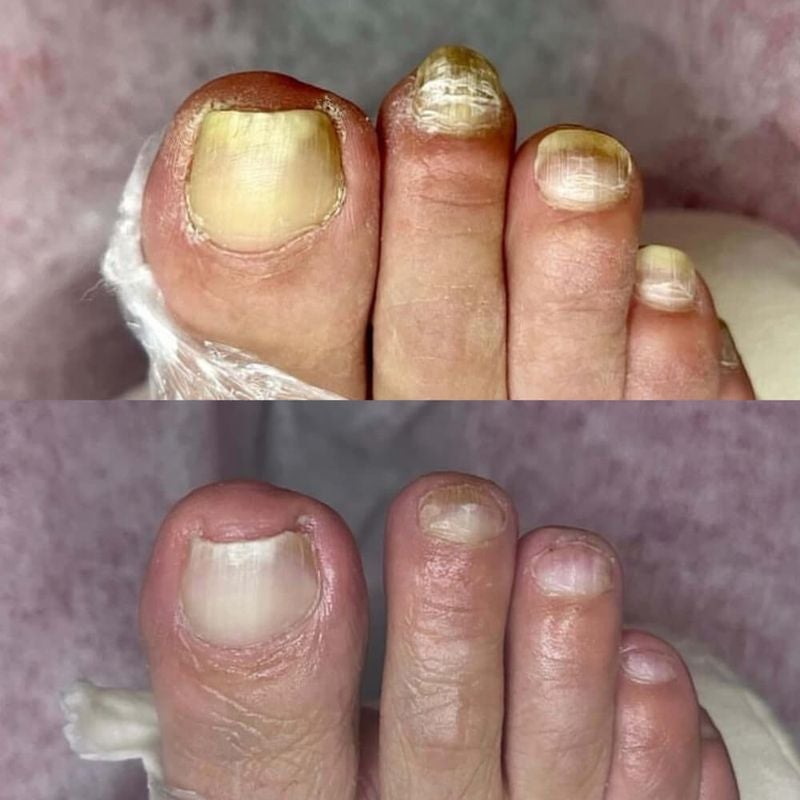 Multiple toenail comparison